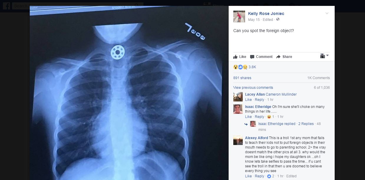 Texas mom's spinner' post goes viral after daughter swallows one kens5.com
