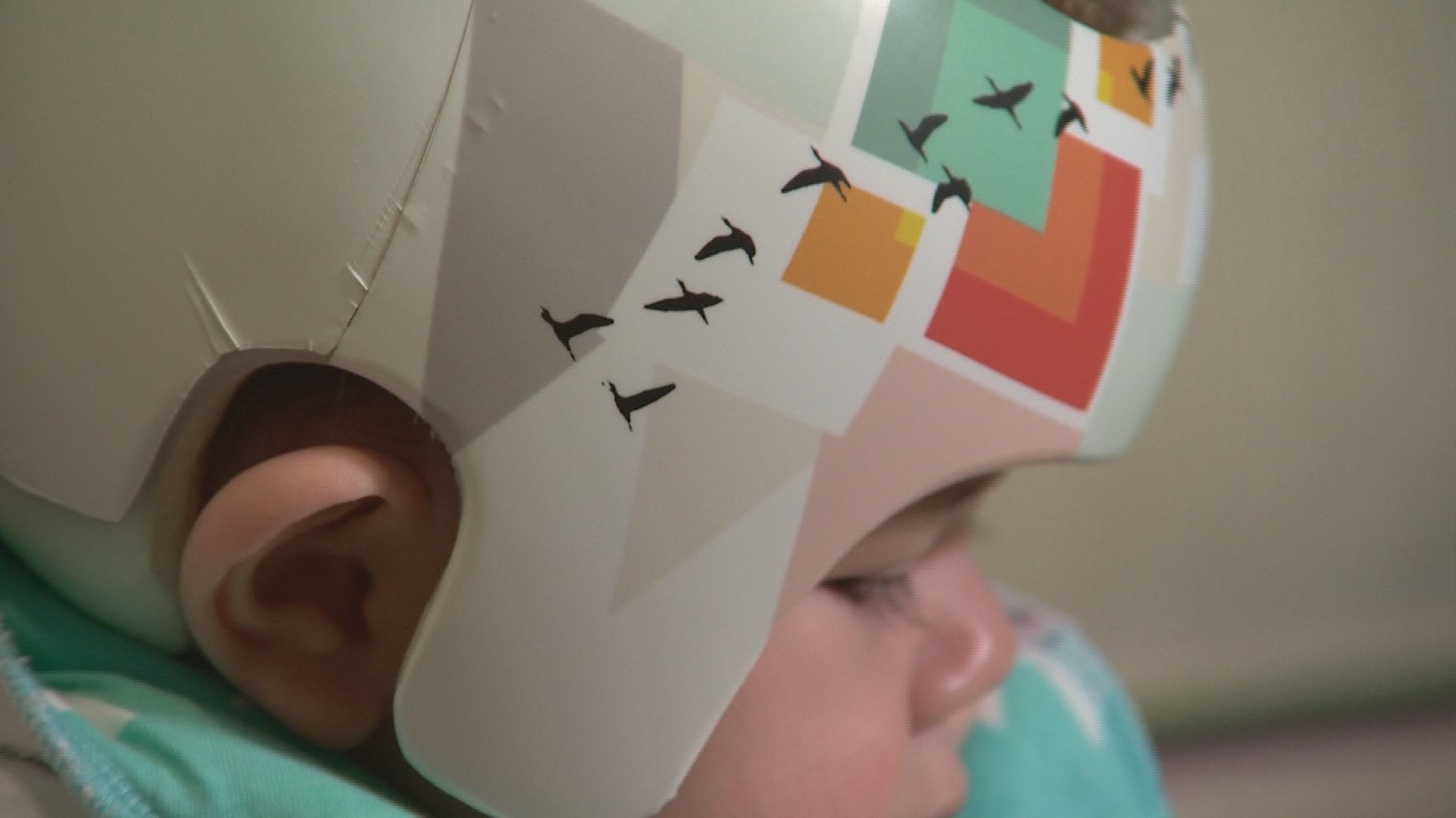 S.A. company makes custom decals for ‘flat head' syndrome helmets